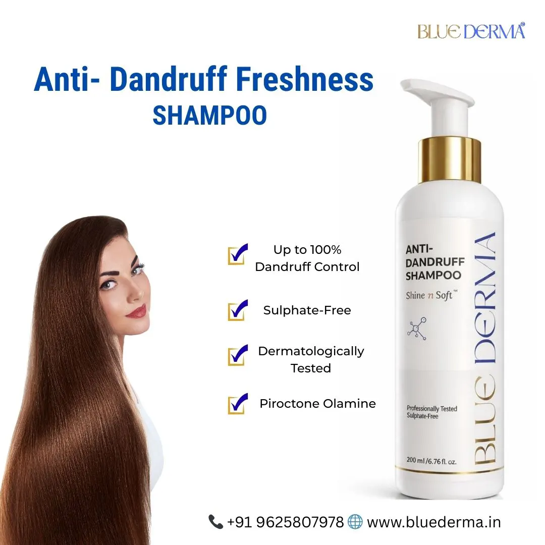 Best Anti Dandruff Shampoo in Delhi: A Dermatology-Inspired Solution for a Healthy Scalp